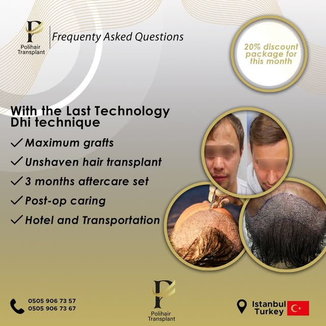 With the Last technology Dhi technique
- maximum grafts
- unshaven hair transplant
- 3 months afterc