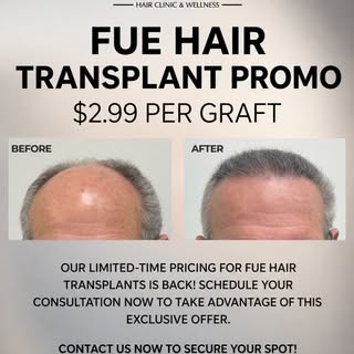 Limited time, real results.☑️
No linear incision. No stitches. Just natural-looking transformation w