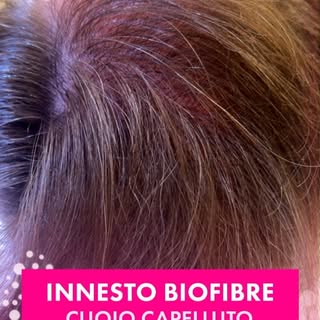 INNESTO DI BIOFIBRE: LA SOLUZIONE AL DIRADAMENTO CAPILLARE ⬇️

Un mese fa abbiamo realizzato un im