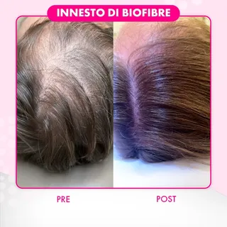 ECCO COME CONTRASTARE IL DIRADAMENTO CAPILLARE ⬇️

Vedere la propria chioma perdere densità incide
