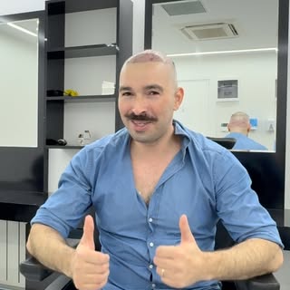 Day 2 after my hair transplant in Turkey. I came all the way from Spain and honestly — zero regrets.