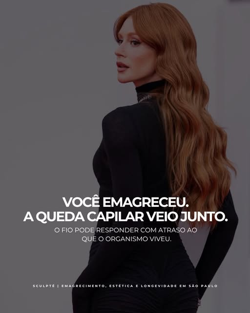 A queda de cabelo após o emagrecimento pode aparecer semanas ou meses depois, e nem sempre tem uma ú