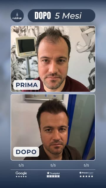 🇮🇹 Un cambiamento che parla da solo. 🔥
Un risultato già denso, naturale e armonioso. E la parte m