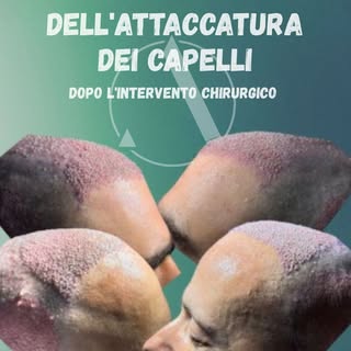 Subito dopo il trapianto, ogni dettaglio racconta la qualità del lavoro svolto.
L'ispezione dell'att