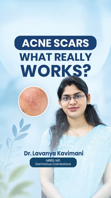 Acne Scars: What Really Works?
Struggling with stubborn acne scars? Discover the effective treatment