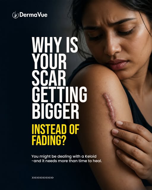 Here’s a suitable Instagram description for this keloid awareness poster series:

Keloids aren’t jus