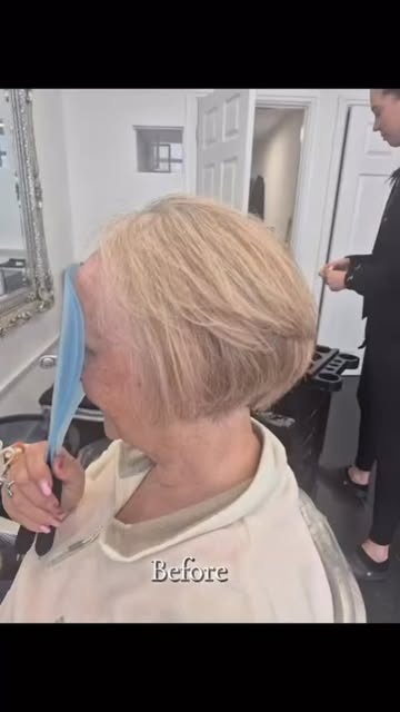 All ladies suffering with FFA a volumesh system will give you a full head of hair and your confidenc