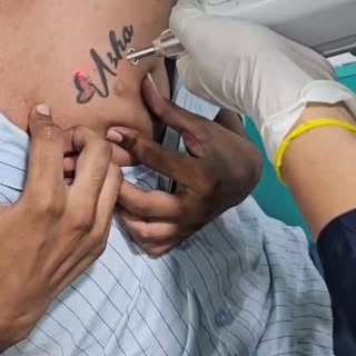 🎯 Ready to fade that unwanted tattoo?
Laser tattoo removal works by targeting tattoo pigments and g