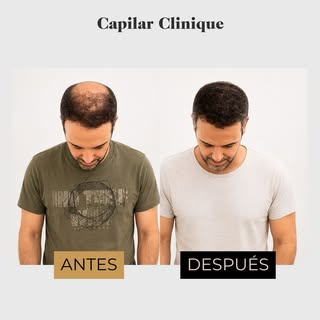 Hay cambios que se ven. Y otros que solo entiende quien llevaba años evitando un espejo, una foto o 