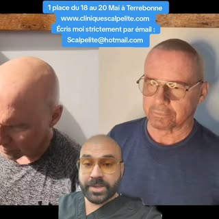 💫Formation Micropigmentation Capillaire Scalp Élite 🤩

1 place: 18 au 20 Mai 2025.. je quitte en F