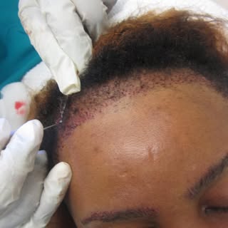 Placement photo! 8/21/18
We GROW HAIR!!!
Natural results ONLY!! Why waste time & money on artificial