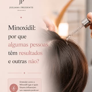 Você já se perguntou por que algumas pessoas recuperam volume capilar com o uso do minoxidil enquant