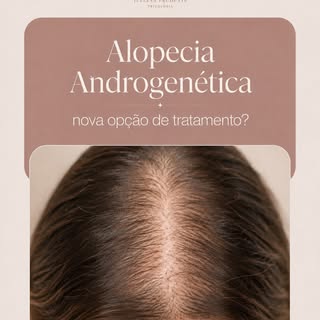 PROSTAGLANDINAS E ALOPECIA ANDROGENÉTICA 🧬

A alopecia androgenética não envolve apenas genética e 