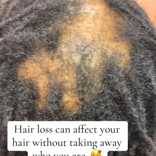 Send this to a woman who needs this reminder today. ❤️#hairloss #fyp #blackwomenhair