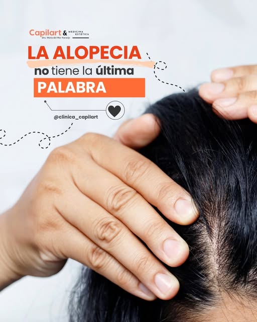 La alopecia puede cambiar tu cabello, pero no tiene por qué definir tu futuro.

Hoy existen tratamie