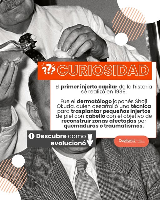 Curiosidad: el injerto capilar tiene más de 85 años de historia.

Aunque hoy asociamos el injerto ca