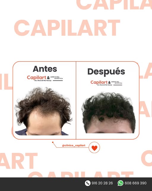 Los resultados hablan por sí solos.

Detrás de un antes y un después como este hay mucho más que rec