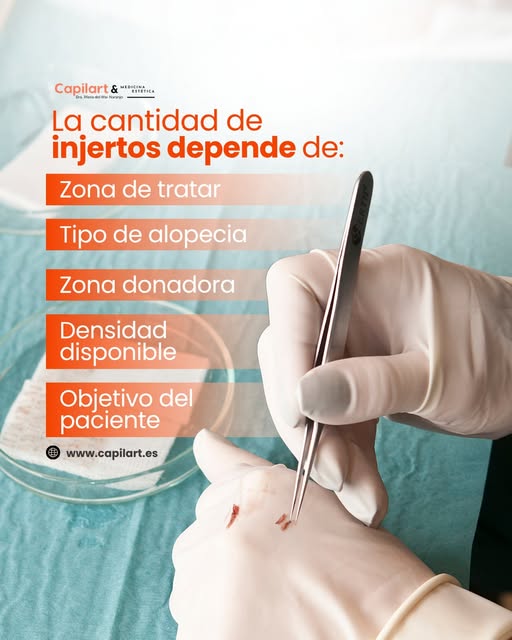 ¿Cuántos injertos necesitas para recuperar tu cabello? La respuesta no es la misma para todos.

En u