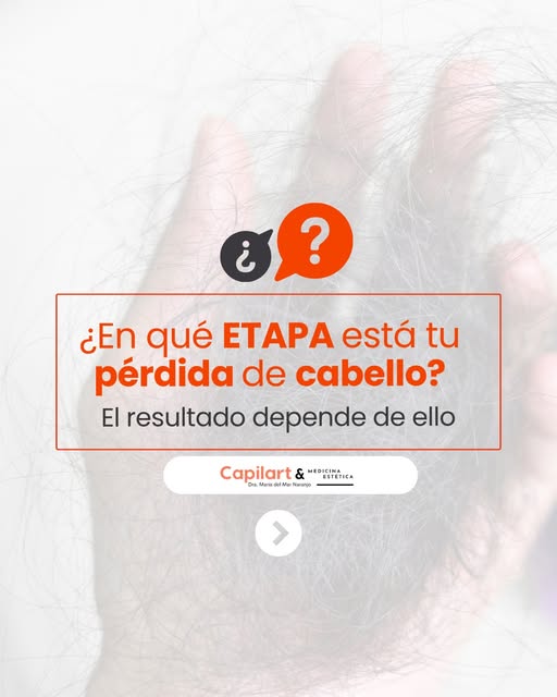 La pérdida de cabello no aparece de un día para otro. Evoluciona, y saber en qué punto estás puede m