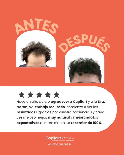 Un año después, el cambio ya habla por sí solo.

En un injerto capilar, los resultados no aparecen d