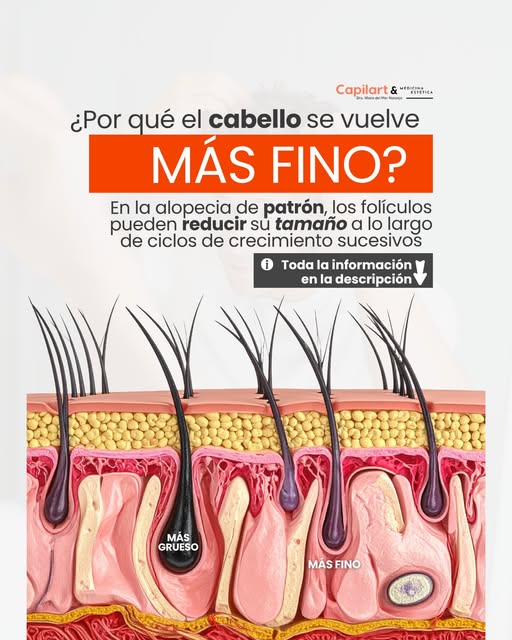 Tu cabello no se vuelve más fino de un día para otro. El cambio ocurre poco a poco, ciclo tras ciclo