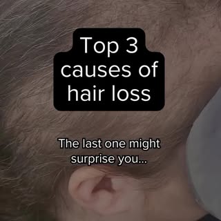 Hair loss can be a distressing experience, but understanding the main causes can help you take the r