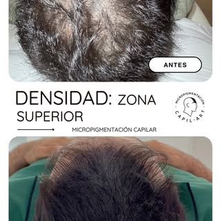 No todos los casos empiezan desde cero. Algunos empiezan con años de frustración.

En este caso no s