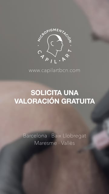 ¿Notas que cada vez se te ve más el cuero cabelludo?

La micropigmentación capilar permite reducir v