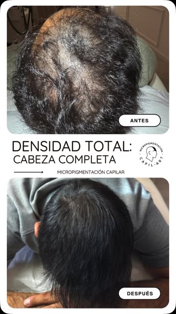 No se trata de crear más cabello. Se trata de cambiar cómo lo percibe el ojo. 🔎

En este caso traba