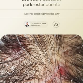 O couro cabeludo é a base da saúde capilar.
Muitas pessoas tratam apenas o cabelo e ignoram os sinai