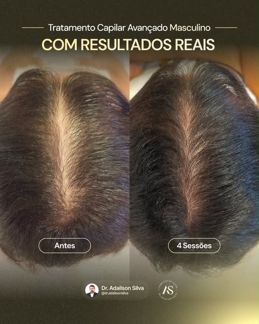 Se este antes e depois apareceu para você hoje, aproveite para se fazer uma pergunta: como anda a sa