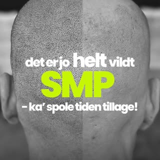 Se selvtillid i spejlet igen. 👀✨

Før: Et konstant minde om hårtab. Efter: Et naturligt og fyldigt 