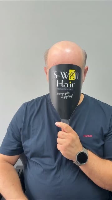 Özgüven, Motivasyon, Mutluluk
Sadece 2 Saatte Hepsini Geri Kazanın..
S-Well Hair Protez Saç Merkezle