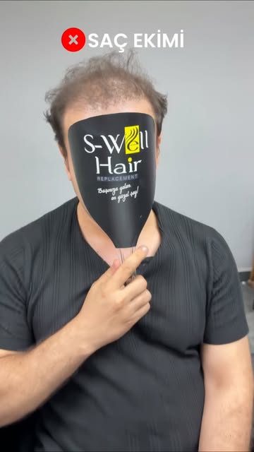 Müşterilerimizin %80 i daha önceden saç ekimi yaptıranlardan oluşuyor... 

S-Well Hair Protez Saç Si