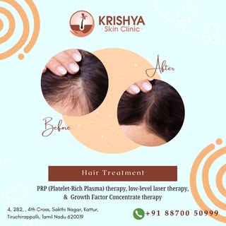 Tired of seeing more hair on your brush than on your head? Get ready for real change! 🌟
​At Krishya