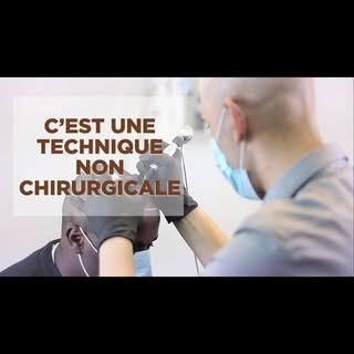 La Tricopigmentation ou dermopigmentation capillaire est une technique non chirurgicale qui permet d