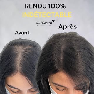 Ma cliente vivait très difficilement sa perte de cheveux diffuse. Très exigeante de nature, elle m’a