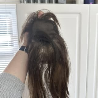 Out with the old, in with the new. This client came to me seeking help with her worn hair system. We