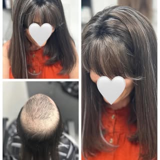 This was fun 🖤🤍✨
 Top Of the Head Human Hair Enhancement for Alopecia — tell us what you want and 