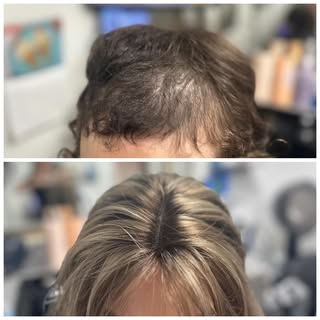 Maintaining hair growth and promoting hair regrowth is our top priority🤍 wearing a hair system is o