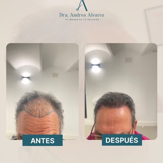 “Yo ya no me reconocía en el espejo. Cada vez me peinaba menos… o me tapaba más”…

Eso fue lo que me