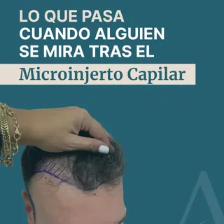 No es solo pelo. Es volver a reconocerte.

He visto a hombres y mujeres emocionarse frente al espejo