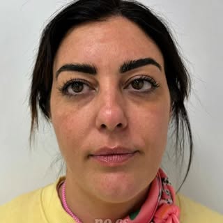 Cuando se trabaja el rostro de forma global… se nota👌🏼 

Un ángulo mandibular más definido, una mi