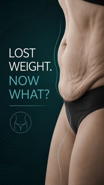 You lost the weight. But what happens to the skin?

Significant weight loss can be life-changing — b