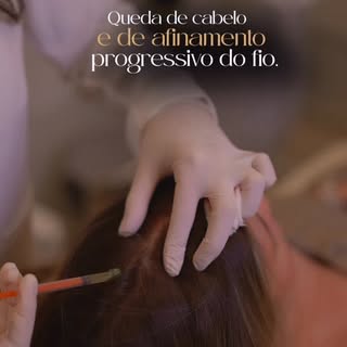 Muitas pacientes jovens com alopecia androgenética compareceram ao consultório queixando de queda e 