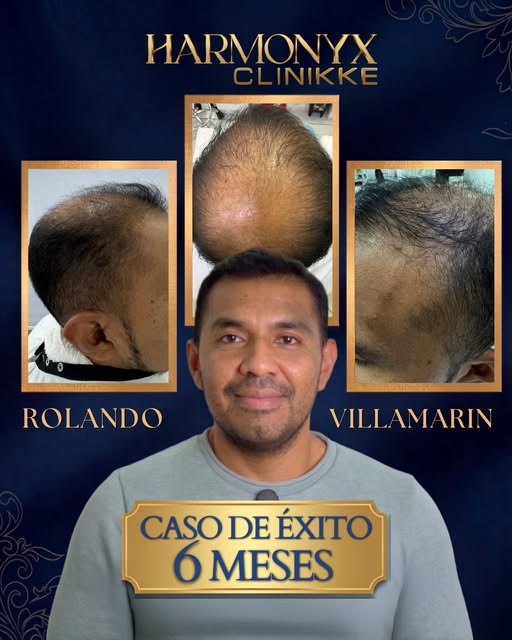 Resultados reales que transforman vidas. Les compartimos el caso de éxito de nuestro paciente Roland