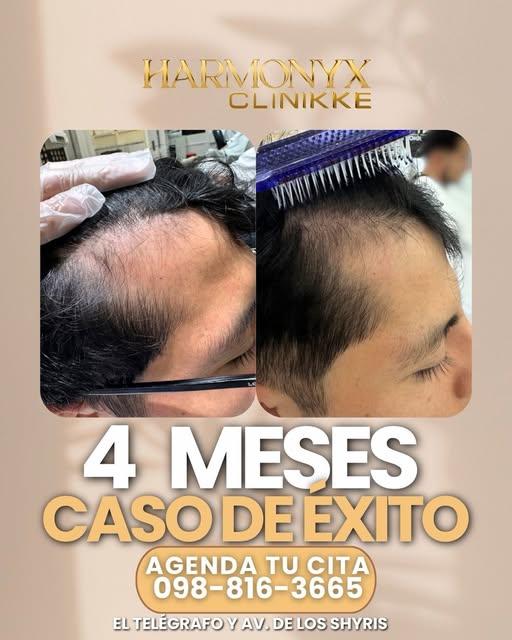 Resultados reales que transforman vidas. Les compartimos este increíble caso de éxito tras 4 meses d