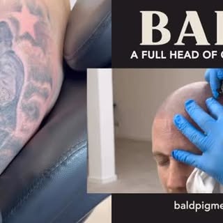 BALD – A Full Head of Confidence.
Van micro haar pigmentatie tot tattoo-verwijdering: bij BALD creër