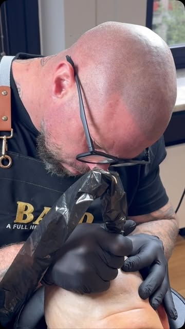 I’m Tim, owner of BALD in Heerlen.
Specialised in MHP, tattoo removal and laser treatments.

These w