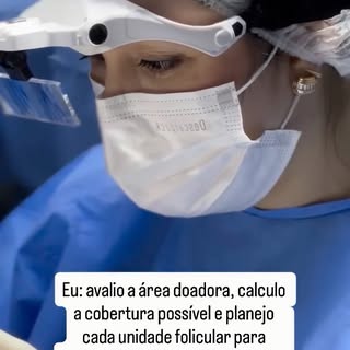 Transplante capilar não é competição por número de fios.

A área doadora é um recurso limitado. Cada